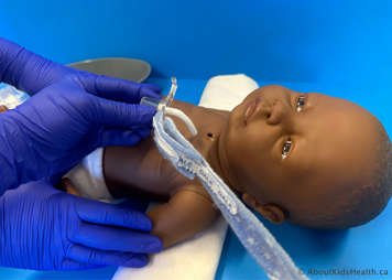 Child's tracheostomy tube has been removed