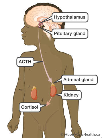 ACTH going from pituitary gland to adrenal gland which then produces cortisol