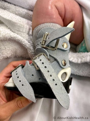 Looking through the hole in the back of the boot to make sure the heel is fully down and back