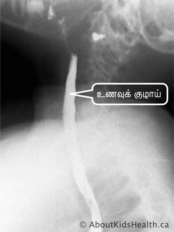 களத்தின் கதிரியக்கப்படம்  (X-ray