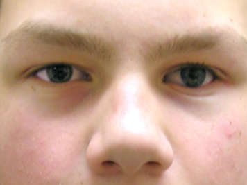 Close-up of an older boy’s eyes