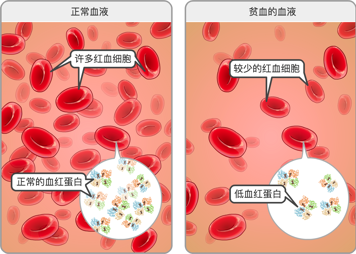 正常血液中有大量的红细胞，且血红蛋白含量正常；而贫血者血液内红细胞数量较少，血红蛋白含量较低