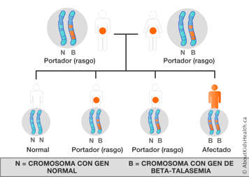 Tabla de distribución de cromosomas de un hombre y una mujer, ambos portadores del gen de la beta talasemia en un cromosoma