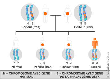 La distribution des chromosomes d’un homme et d’une femme, chacun avec un chromosome avec un gène de bêta-thalassémie