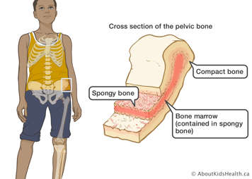 Cross section of the pelvic bone identifying compact bone, spongy bone and bone marrow (contained in spongy bone)