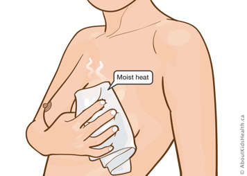 Hot compress on the breast