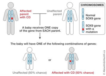Chromosome distribution from an affected parent with CD and an unaffected parent