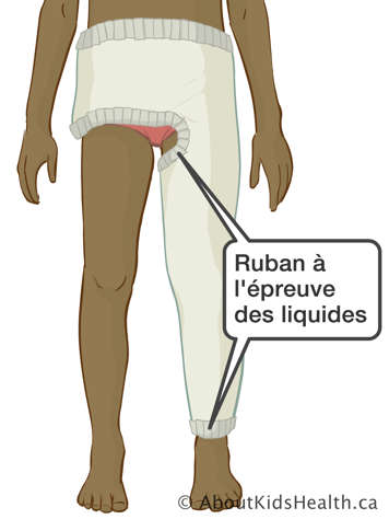Enfant portant un spica pour les hanches avec ruban à l’épreuve des liquides sur les deux hanches et une jambe