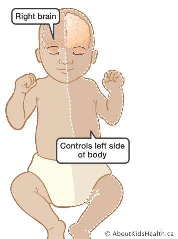 Illustration showing that the right side of a baby’s brain controls the left side of the body