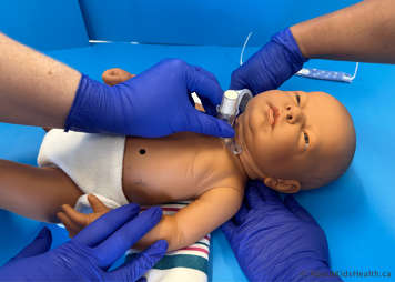 Removing tracheostomy tube ties from one side