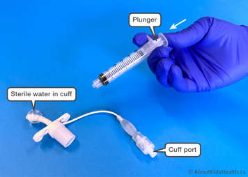 pushing plunger in on a Luer-Lok tip syringe