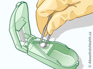 Gloved hand placing tablet into a pill splitter using tweezers
