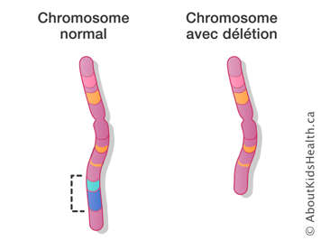 Un chromosome normal et un chromosome avec délétion