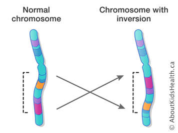 Normal chromosome and chromosome with inversion