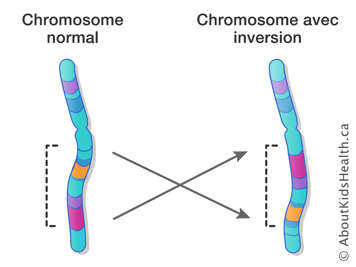 Un chromosome normal et un chromosome avec inversion
