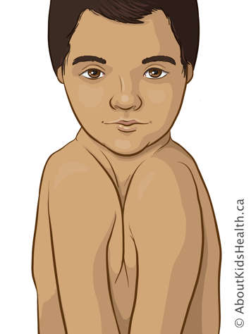 Child with both shoulders and arms together directly in front of chest