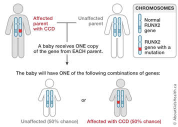 Chromosome distribution from an affected parent with CCD and an unaffected parent