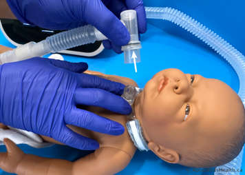 Removing the tracheostomy adaptor to suction the child after CoughAssist treatment