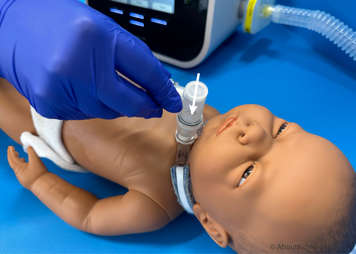 A tracheostomy adaptor being attached to a child