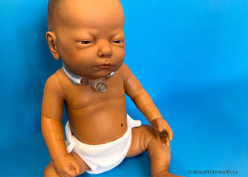 A child with a tracheostomy tube sitting comfortably