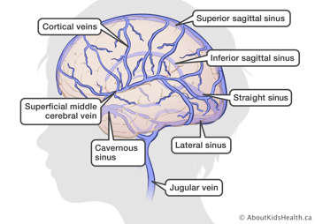 Identification of veins and sinuses in the brain