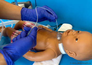 Suction catheter slowly being removed from the tracheostomy tube