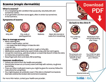 Clickable thumbnail of the eczema or atopic dermatitis at a glance handout