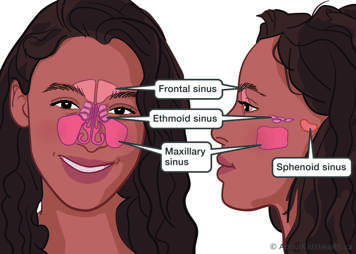 Frontal sinus in forehead, ethmoid sinus between eyes, maxillary sinus in cheeks beside nose, sphenoid sinus near ear