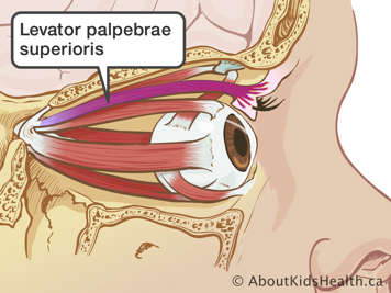 Medical illustration the levator palpebrae superioris, which is a muscle that extends from behind the eye to the upper eyelid