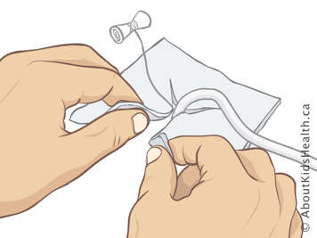 Placing gauze with y-cut around C-tube