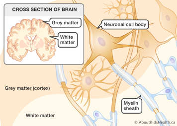 Cross section of the brain with grey matter, white matter, neuronal cell body and myelin sheath identified