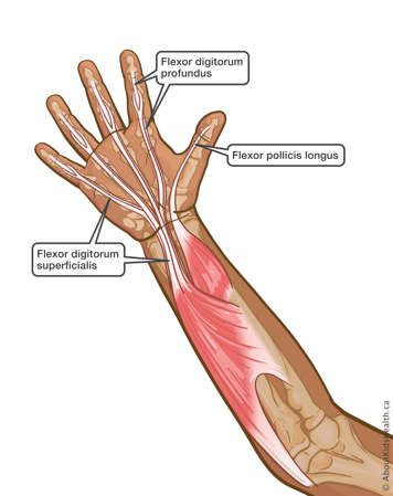 The hand and forearm showing tendons that can be injured if you have a flexor tendon injury