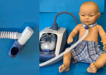 child with a heated high flow humidifier tracheostomy adaptor and an inset showing a close up of a heated high flow humidifier tracheostomy adaptor