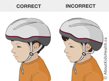 Position correcte et position incorrecte d’un casque sur la tête d’un enfant