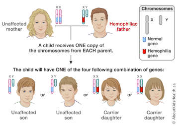 Distribution of X and Y chromosomes from unaffected mother and hemopheliac father, producing four possible results