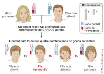 Distribution des chromosomes X et Y d’une mère porteuse et d’un père non atteint, produisant quatre résultats possibles