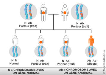 Distribution des chromosomes des parents porteurs, chacun portant un chromosome avec un gène anormal