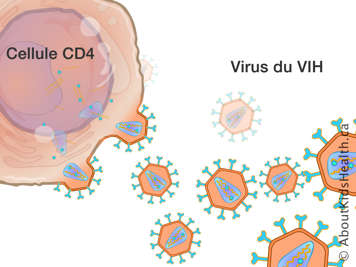 Des virus VIH dedans et autour d’une cellule CD4
