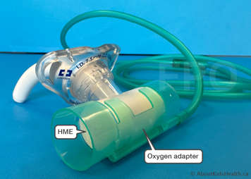 Close-up of an inline HME on tracheostomy tube with oxygen adaptor