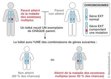 Distribution des chromosomes d’un parent atteint de la maladie des exostoses multiples et d’un parent non atteint