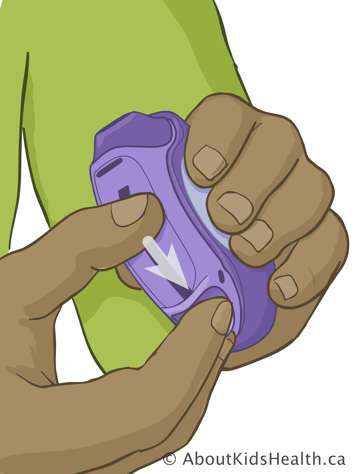 Placing first finger on thumb grip of Diskus inhaler and using thumb to slide tab down toward the first finger