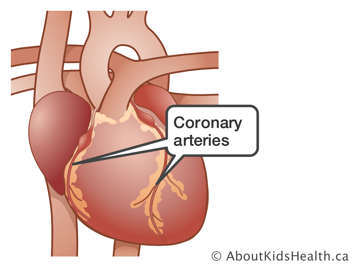 Coronary arteries in the heart