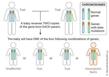 Chromosome distribution chart for a male and a female both carrying the beta thalassemia gene in one chromosome