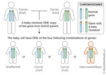 Chromosome distribution chart for a male and a female both carrying the beta thalassemia gene in one chromosome