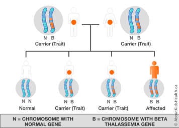 Chromosome distribution chart for a male and a female both carrying the beta thalassemia gene in one chromosome