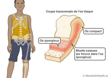 Coupe transversal de l’os iliaque montrant l’os compact, l’os spongieux et la moelle osseuse (se trouve dans l’os spongieux)