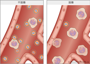 未用藥情況下，血液中有若干HIV細胞；用藥後，血液中僅有一個HIV細胞