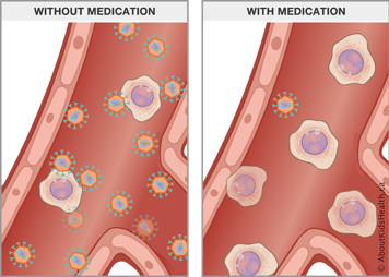 Several HIV cells in blood without medication and only one HIV cell in blood with medication