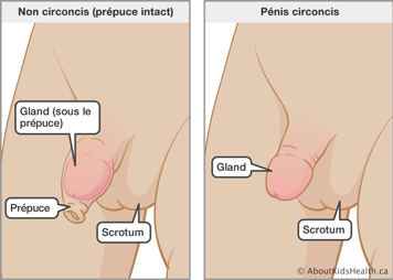 Identification du gland, du prépuce et du scrotum d'un pénis non circoncis et du gland et du scrotum d'un pénis circoncis