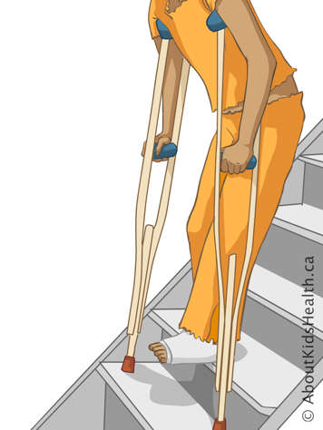 Descending stairs using two crutches